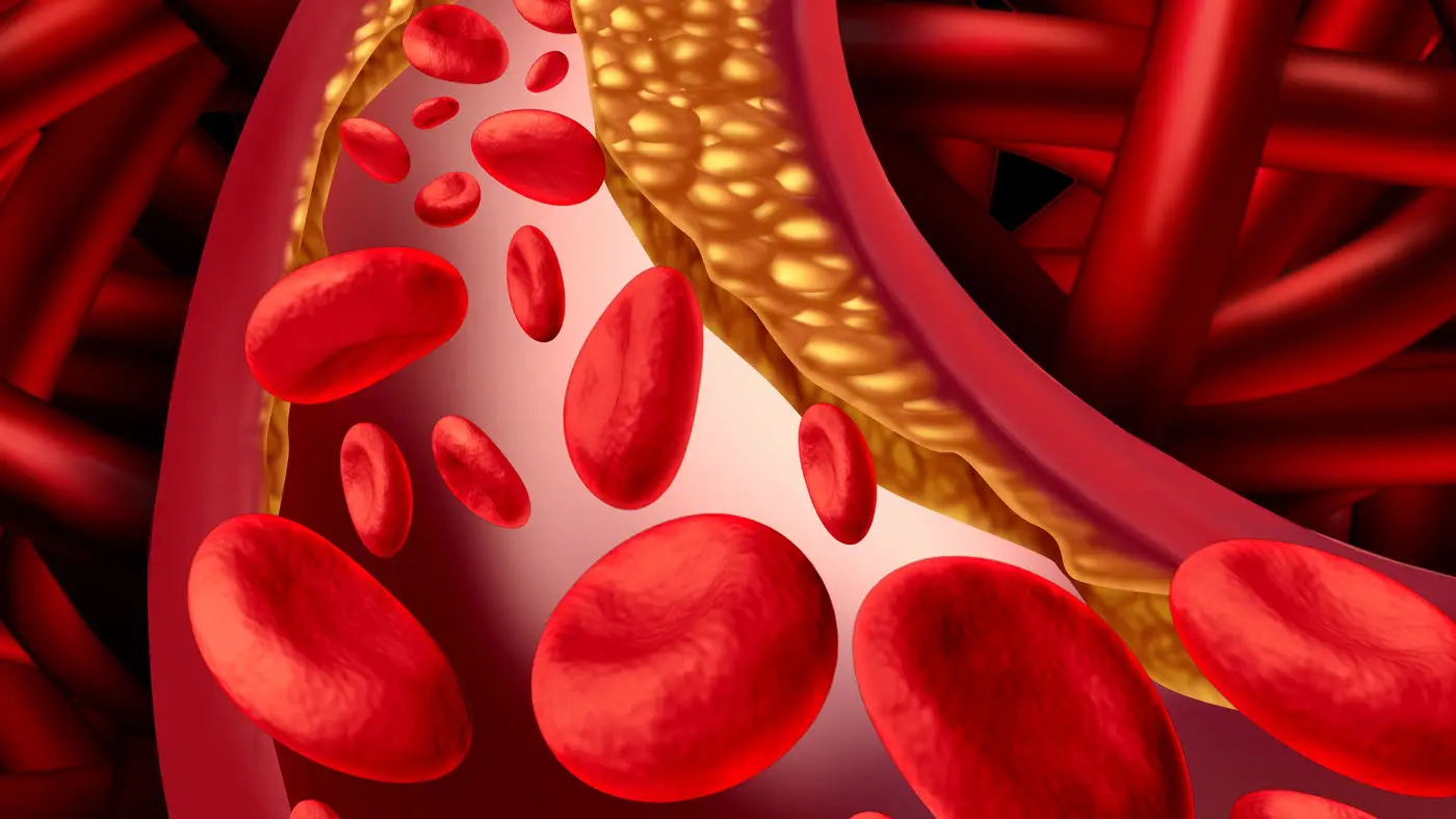Bevi questo al mattino per iniziare subito a pulire le tue arterie naturalmente